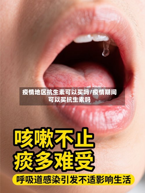 疫情地区抗生素可以买吗/疫情期间可以买抗生素吗-第2张图片