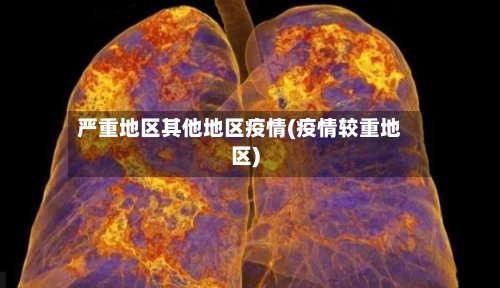 严重地区其他地区疫情(疫情较重地区)
