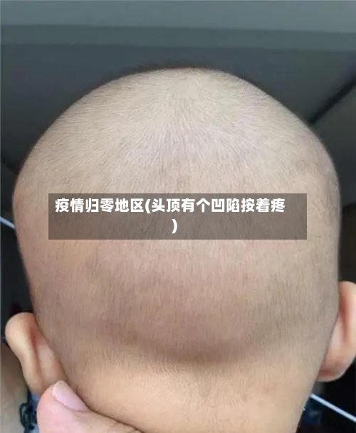 疫情归零地区(头顶有个凹陷按着疼)-第2张图片