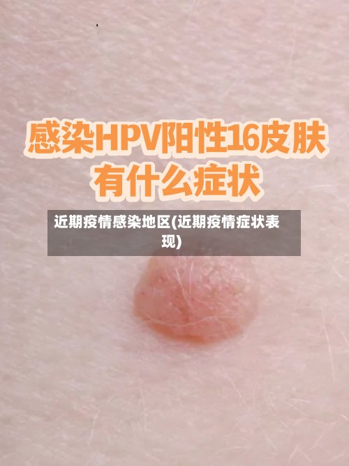 近期疫情感染地区(近期疫情症状表现)-第2张图片