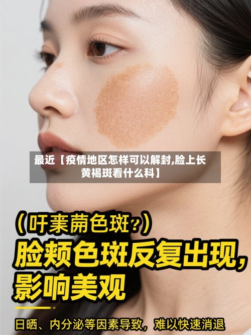 最近【疫情地区怎样可以解封,脸上长黄褐斑看什么科】