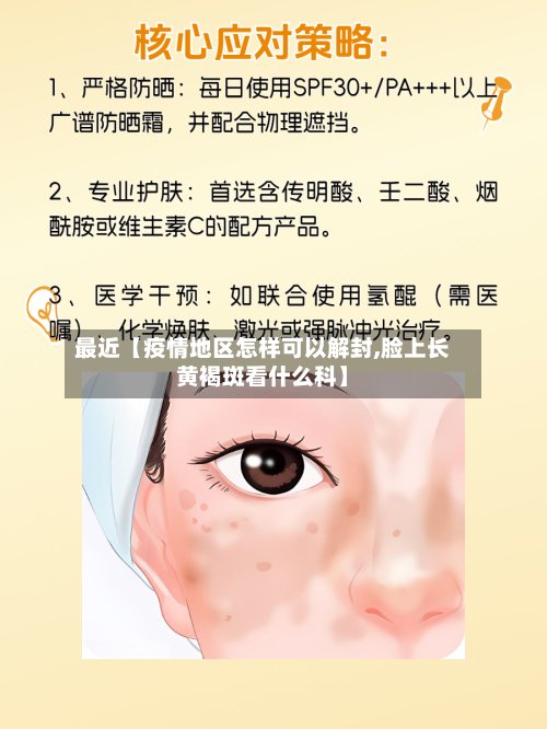 最近【疫情地区怎样可以解封,脸上长黄褐斑看什么科】-第2张图片