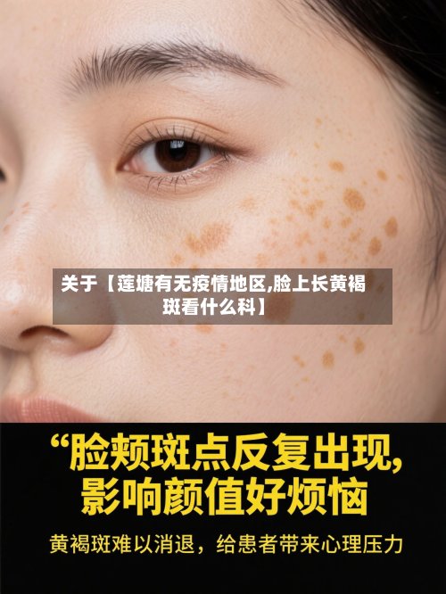 关于【莲塘有无疫情地区,脸上长黄褐斑看什么科】-第3张图片